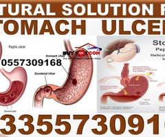 NATURAL REMEDY FOR STOMACH ULCER