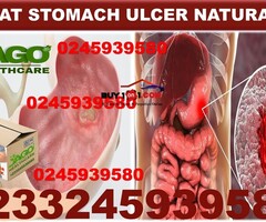 Natural Solution For STOMACH ULCER